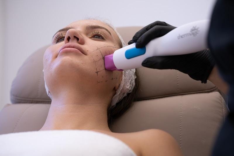 Top 2 tratamente faciale de care mi-aș dori să mă bucur în viitorul apropiat 2 Top 2 Tratamente Faciale